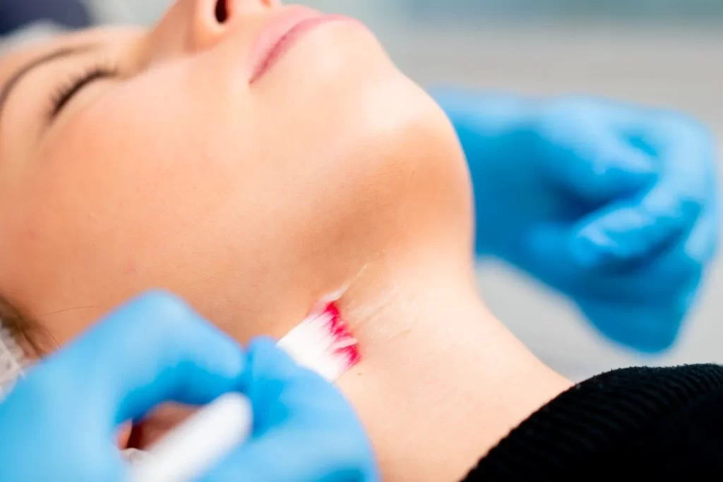 Thyroid surgery (Thyroidectomy)